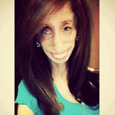 Lizzie Velasquez